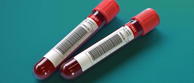 Des tubes à essai étiquetés avec la présence de codes-barres